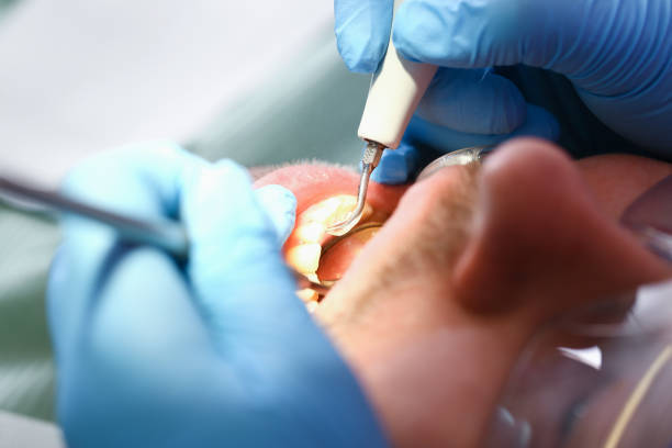 Best Walk-In Emergency Dental Services in Suffield Depot, CT